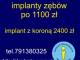 implanty_zebow_od_1100_zl